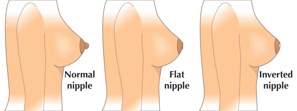 So there are supposedly eight types of nipples